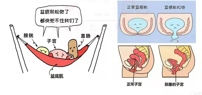 关爱女性健康 注重产后康复