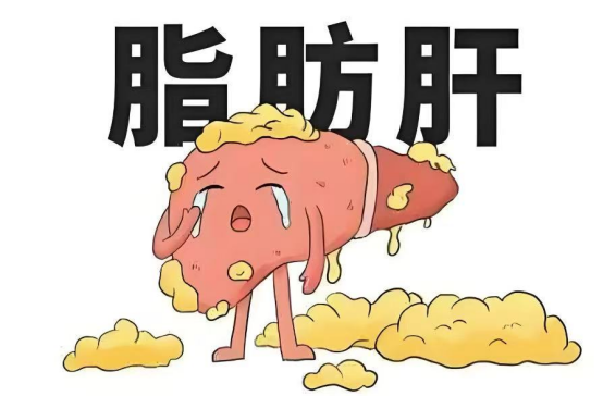 健康科普 | 警惕“无声杀手”——脂肪肝不容忽视融安人医 2025年05月21日 20:09 广西